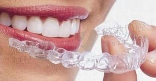 假牙有合金的和树脂的区别,树脂假牙的利与弊(图1)